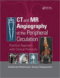 کتاب CT and MR Angiography of the Peripheral Circulation زبان اصلی
